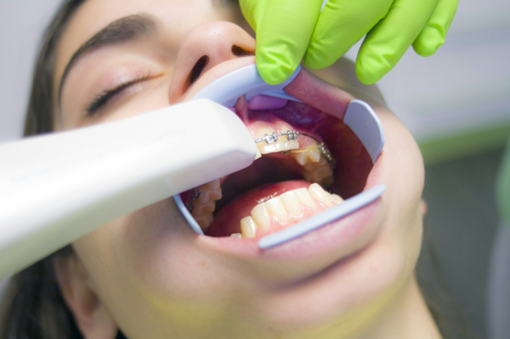 pediatric dentists putting braces on a kid